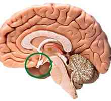 Adenom hipofize u mozgu