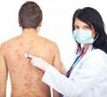 Alergični na kožu, alergijski osip na koži