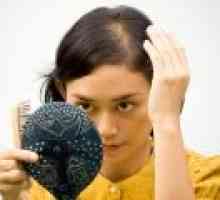 Alopecija kod žena - što učiniti s kosom?