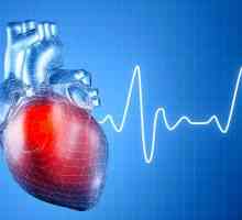 Srčana aritmija: simptoma, liječenje