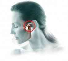 Artritis maksilofacijalni zajednički simptomi i liječenje