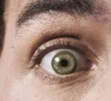 Atrofija očnog živca, uzrokuje, efekte i liječenje