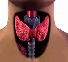 Autoimuni tiroiditis štitnjače
