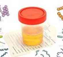 Bakterije u urinu (bakteriuriju): uzroka, simptoma, liječenje