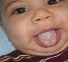 Bijeli jezik premaz u dojenčadi - uzroci, simptomi, liječenje