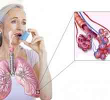 Astma: Simptomi i liječenje