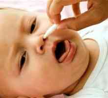Kako liječiti curenje iz nosa u djece kod kuće