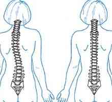 Što će kiropraktičar za bolove u leđima?