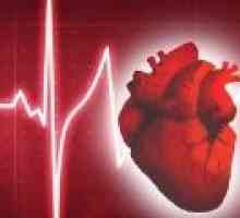 Što je nenormalan srčani ritam?