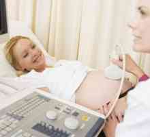 Dopler ultrazvuk u trudnoći - što je to?