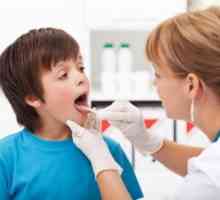 Faringitis u djece - Simptomi i liječenje faringitisa djeteta