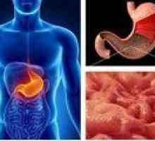 Gastritis s niskim kiselosti: Simptomi i liječenje