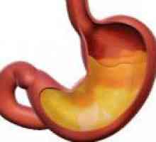 Gastritis niske kiselosti - simptoma, liječenje