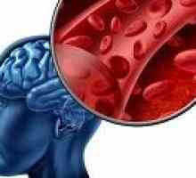 Hemoragijski moždani udar: uzroci, simptomi, liječenje