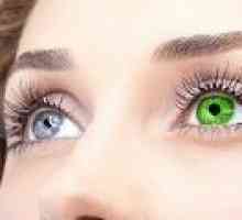 Heterochromia očiju: uzroci, simptomi, liječenje