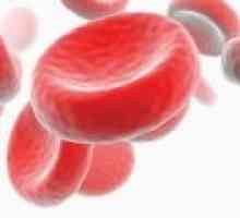 Hipokromnih anemije: Vrste i liječenje