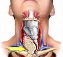 Hipoplazija lijeve vertebralne arterije: što je to?