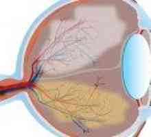 Glaukom - prevenciju i liječenje glaukoma