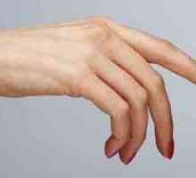 Hladne ruke jedne žene su prirodni faktor!