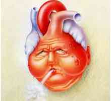 Kronično zatajenje srca