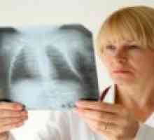 Kronična upala pluća: simptomi, liječenje