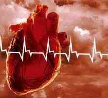 Srčani udar, uzroci srčanog udara