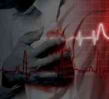 Koronarna bolest srca i stentiranje plovila srca