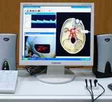 Upotreba vratne žile triplex skeniranje i mozgu