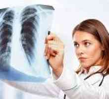 Hydatidosa bolest pluća, što je to?