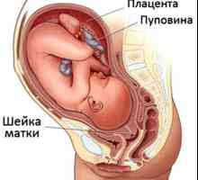 Cervikalna erozija i trudnoća