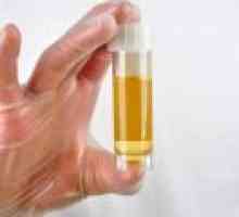 Kako proći test urina tijekom trudnoće?