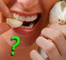 Kako ukloniti zubni živac u kući?