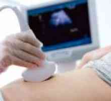 Kada se prvi ultrazvuk u trudnoći?
