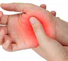 Liječenje artritisa u kući narodnih lijekova
