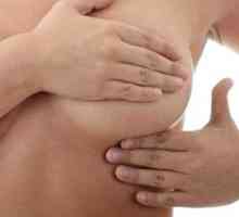 Liječenje fibrocističnu bolest dojke