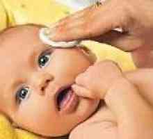 Liječenje konjunktivitisa u djece