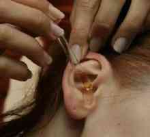 Liječenje upale srednjeg uha - srednje, gnojna, vanjski, liječenje upale srednjeg uha kod djece