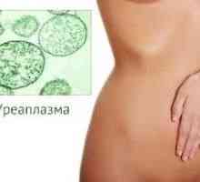 Liječenje Ureaplasma u žena, kod muškaraca