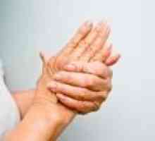 Bolan zglobova ruku i nogu: uzroci, liječenje