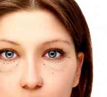 Vrećice ispod očiju: uzroci i liječenje