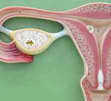 Fibroidi maternice veličine za operacije