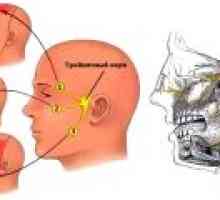 Neuralgije facijalnog živca: simptomi, liječenje