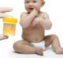 Norme urina u odraslih, kod djece
