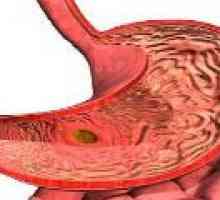 Fokalna atrofični gastritis: uzroci, simptomi, liječenje