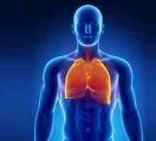 Žarišna plućna tuberkuloza: uzroka, simptoma, liječenje