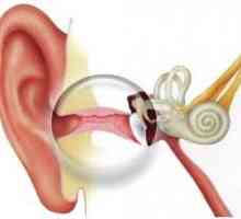 Akutna upala srednjeg uha - u prosjeku, gnojna, katar, akutna upala srednjeg uha kod djece,…