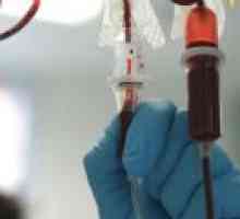 Transfuzija krvi iz vene u stražnjice