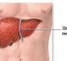 Prvi znakovi ciroze jetre