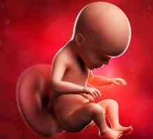 Plod trudna 26 tjedana