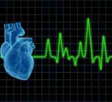 Pomoć u kardiogeni šok